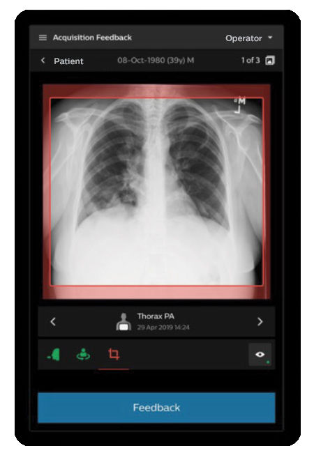 Philips Radiology Smart Assistant